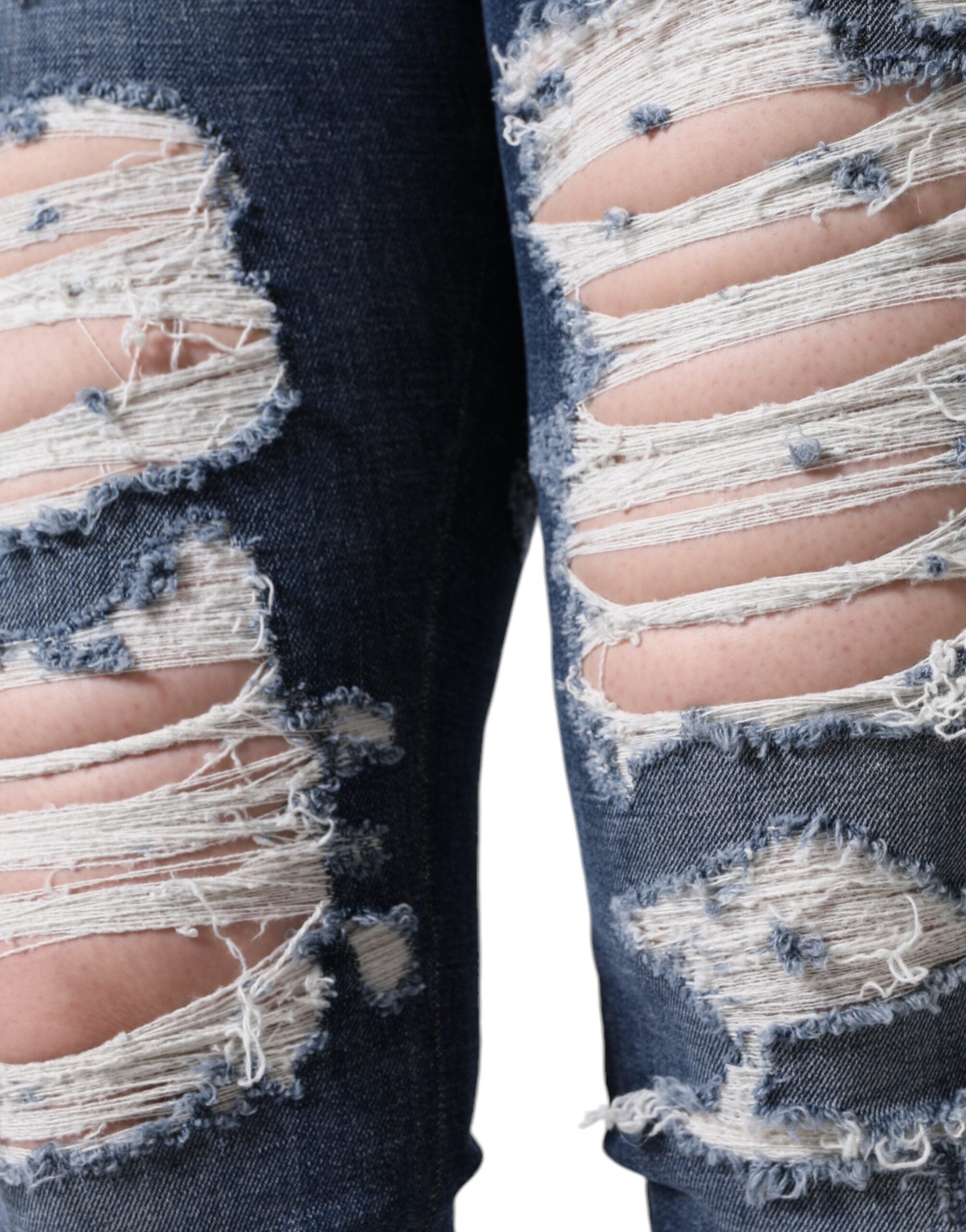 Blåa, slitna skinny jeans i bomull med stretch